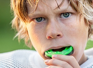 Teen boy placing sports mouthguards