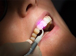 Closeup of patient receiving laser treatment