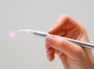 Hand holding a dental laser