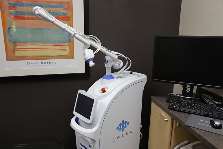 Solea laser system