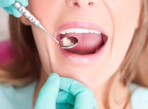 Closeup of smile during dental treatment