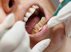 Closeup of laser dentistry treatment