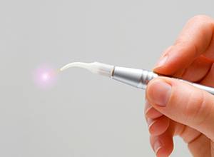 Soft tissue laser hand tool