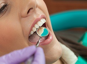 Closeup of patient receiving dental treatment